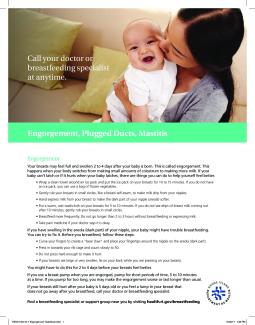Engorgement Plugged Ducts Mastitis
